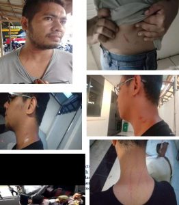 Peryataan Sikap PP GMKI Terhadap Tindakan Represif Pihak Polres Pulau Ambon P.P Lease